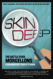 دانلود مستند Skin Deep: The Battle Over Morgellons 2019104233-410419118